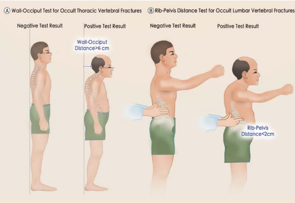 Postural Assessment Copy Bone Fit™
